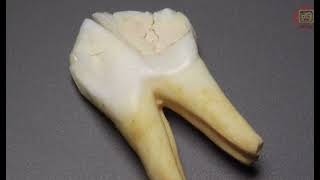 Growing a third set of teeth is now possible!! New drug testing on toothless kids