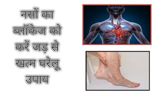 नसों की ब्लॉकेज || नस में खून का दौरान बंद हो जाना, veins blockage, नसों में ब्लॉकेज का घरेलू उपाय