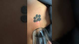 Laser tattoo removal , first treatment female shoulder tiger paw