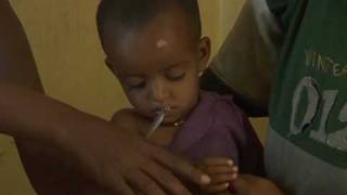 HealthPhone™ Amharic - Exercise 2 - Assessing, Classifying - Management of Severe Acute Malnutrition