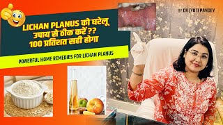 Lichen planus को घरेलू उपाय से ठीक करें || 100 प्रतिशत सही होगा ||