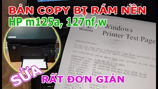 Máy in HP Pro m125a Bản Copy bị Rám nền | Sửa không tốn 1 xu