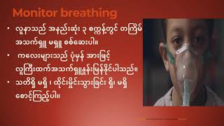 ချွန်ထက်သော အရာကြောင့်မဟုတ်ဘဲ ဦးခေါင်းဆောင့်မိ၍ ရရှိသော ဦးခေါင်းဒဏ်ရာ ရှေးဦးသူနာပြုစုနည်း