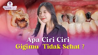 INILAH CIRI-CIRI GIGI TIDAK SEHAT