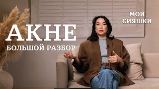 Забудьте об АКНЕ: Советы от Жанны Нуралы

#Акне #чистаякожа #лечениеакне #причиныакне