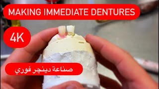 MAKING DENTURES (immediate)4K صناعة دينچر فوري بعد القلع