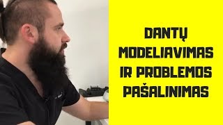 Odontologijos klinika Vilniuje Dantų modeliavimas ir problemos pašalinimas