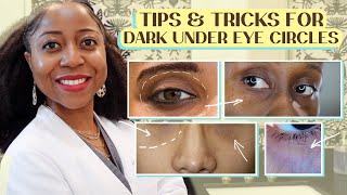 Tips and Tricks for Dark Under Eye Circles from a Derm |@BrownSkinDerm