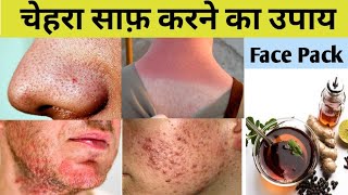 Permanent Skin Whitening home remedies | Skin Transformation