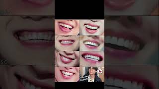 ARMY can you guess this lips 👄#bts #youtubeshorts #ytshort #ytstudio #youtube#btsvideos #foryou#army