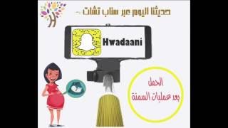 الدكتور حامد الودعاني / حديثنا عبرالسناب شات الحمل بعد عمليات السمنه