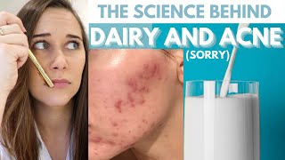 IGF1 in DAIRY CAUSES ACNE! (The science of HOW dairy and acne are linked FINALLY EXPLAINED!)