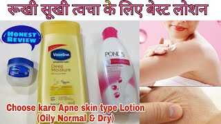 Best Body Lotion for winter❄️in budget || choose best Moisture👍जानिए कोनसा बॉडी लोशन आपको लेना चाहिए