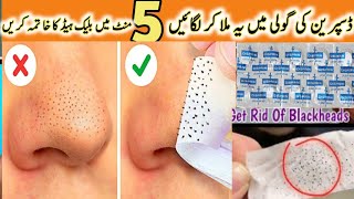 How To Remove BLACKHEADS Permanently From Nose & Face Instantly 💯| Naturally At Home | No Whiteheads