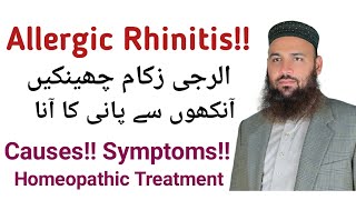 Allergic Rhinitis permanent Cure With Homeopathy | نزلہ زکام الرجی کا مستقل حل