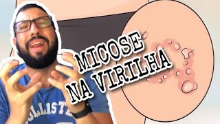 TUDO SOBRE MICOSE DE VIRILHA E COMO SE LIVRAR DELA. Me LEANDRO MOSCARDI