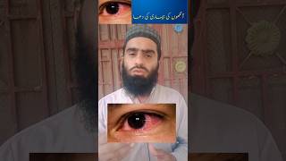 aankhon ki bimari ka wazifa انکھوں کی بیماری کا وظیفہ #abubakar_934 #religion #sov #allah #islamic