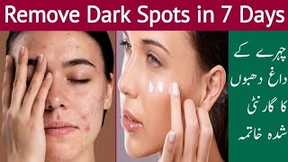 Acne Marks Removal | Get Clear Skin | Glowing Skin Tips | Home remedies | Spice and Glamour