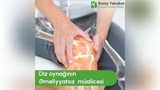 diz oynağının əməliyyatsız müalicəsi