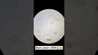 Chicken leg at 400X magnification is super cool!#shorts #fyp #funnyvideos #funny