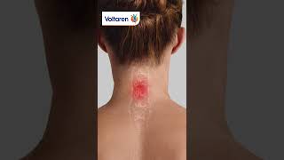 Voltaren