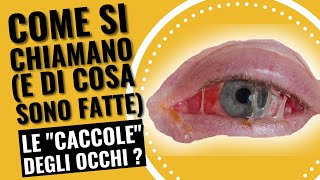 Di cosa sono fatte le "caccole" degli occhi?