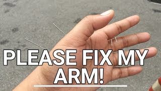 Vlog #7 Please Fix My Arm!