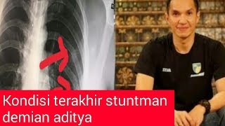 Beginilah kondisi terakhir stuntman demian aditya