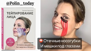 ⛔️ Отечные носогубки и мешки под глазами! #тейпированиелица #тейпированиетела #тейпирование