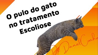 Pulo do gato na escoliose - existe algo que faz toda diferença no tratamento de qualquer escoliose