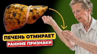 Вашей Печени Грозит Опасность: 6 ранних Признаков того, что ваша ПЕЧЕНЬ ОТМИРАЕТ