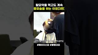 탈모약을 먹고도 블랭크유 증모술을 계속하는 이유 [3편]