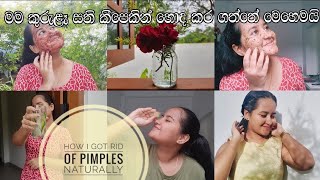 How I Got Rid Of Pimples Fast | Natural Treatments | කුරුලෑ ඉක්මනට හොඳ කර ගත්තු විදිහ | #vlog