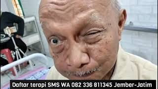 Terapi pengobatan penyakit saraf mata 12 tahun. Master Dwi Ismail Jember Jawa Timur.