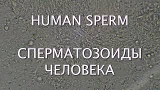 Human sperm - Сперматозоиды человека