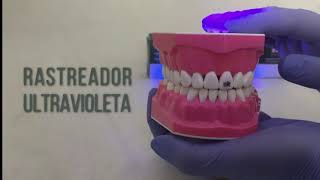 Resina para brackets Smart Ortho Smart Dent - BIOTECH LTDA #ORT3953