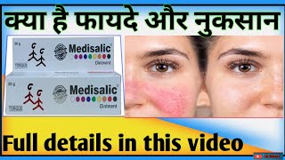 Medisalic ointment ke kya hai fayede or nuksaan how to use medisalic Cream