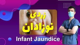 علائم هشدار دهنده زردی نوزادان چیست؟ بعضی زردی ها عوارض جبران ناپذیر دارند: Newborn Jaundice