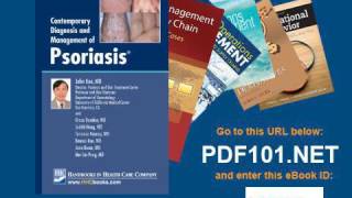 Contemporary Diagnosis And Management Of Psoriasis