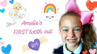 Amelie pulled out her first tooth 🤪😳💥