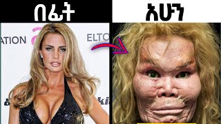 በቀዶ ጥገና ፊታቸውን የቀየሩ አስገራሚ ሰዎች 2 | plastic surgery