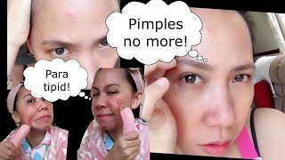 TIPID SKINCARE PIMPLES NO MORE!