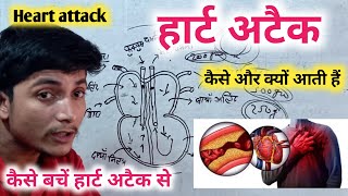 हार्ट अटैक ( Heart attack ) क्यों आती हैं || Heart attack || Heart break || Heart