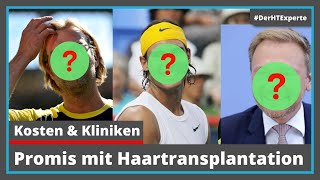 Prominente Männer mit Haartransplantation [Kosten & Kliniken der Stars]