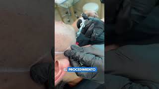 Como corregir tu perfil con un perfilado mandibular. Acá te contamos el paso a paso