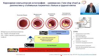 Стабильная ИБС - от "уязвимой" бляшки к "уязвимому" пациенту