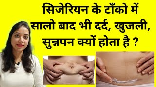 सिजेरियन के टांके में सालो बाद भी दर्द, खुजली होना या सुई चुभना  #cesareanbirth #indianmomsnest