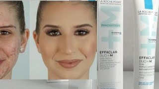 أخطر كريم حيدي الحبوب والبقع والنقط السوداء effaclar duo+ M