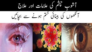 Pink Eye Treatment | Conjunctivitis  | Adenovirus