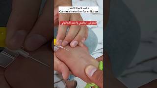 تركيب كانيولا للأطفال Cannula insertion for children